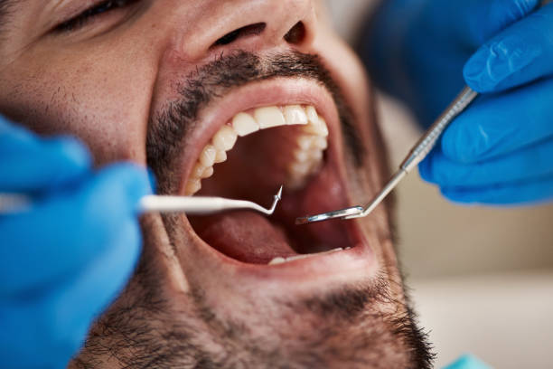 Best Orthodontic Emergency Dentist in Fairland, OK